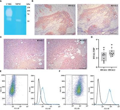 Complement protein C1q stimulates hyaluronic acid degradation via gC1qR/HABP1/p32 in malignant pleural mesothelioma